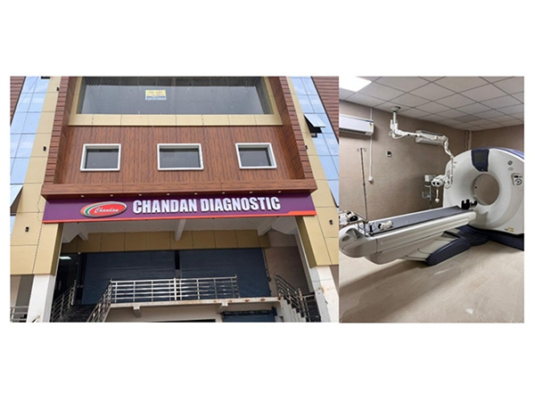 Chandan Healthcare Limited inaugurates second Diagnostic Centre in Ayodhya Chandan Healthcare Limited inaugurates second Diagnostic Centre in Ayodhya