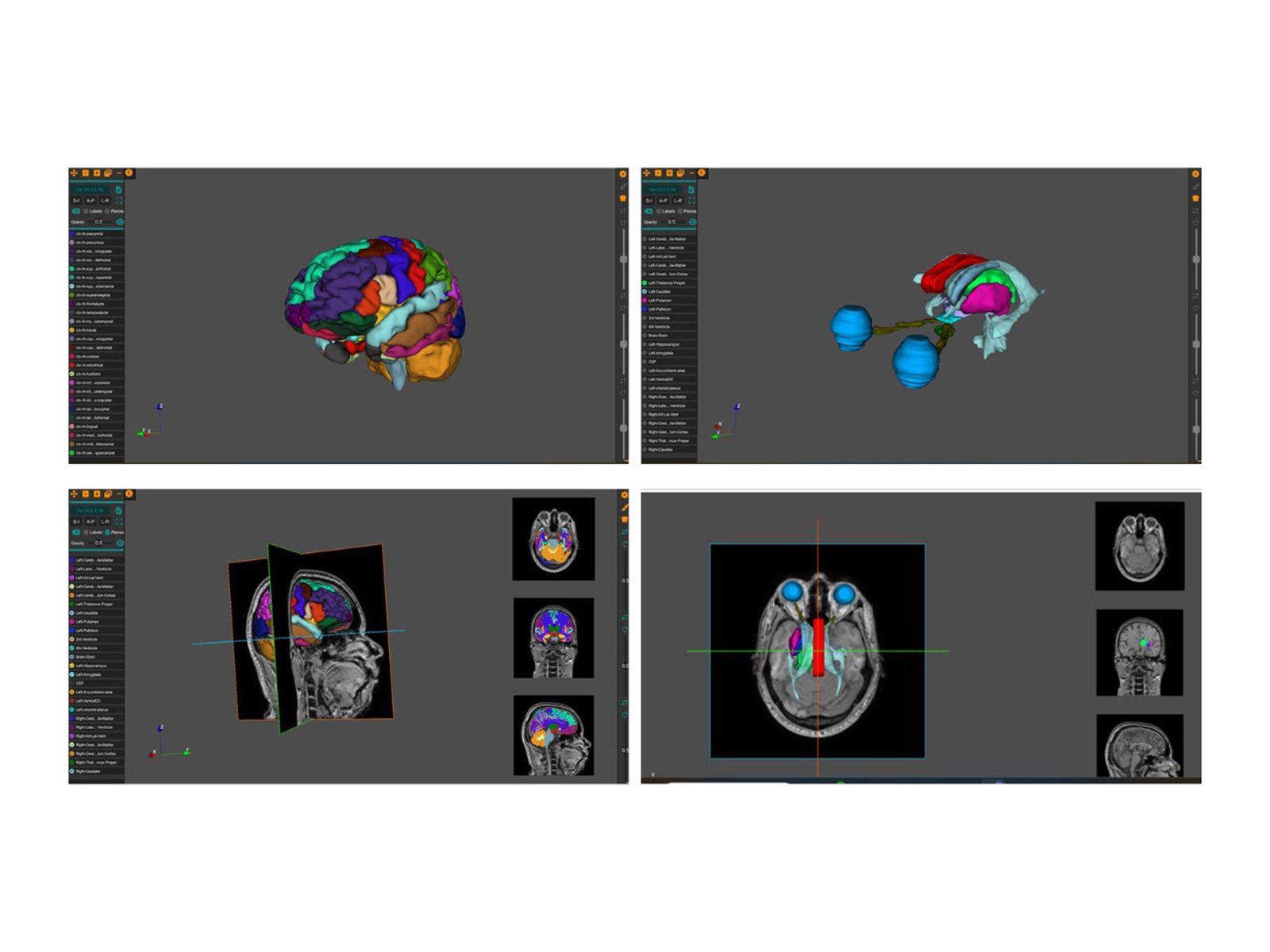 AnaVu: IIIT-Hyderabad’s 3D Anatomy Visualization Platform Transforming Medical Education AnaVu: IIIT-Hyderabad’s 3D Anatomy Visualization Platform Transforming Medical Education