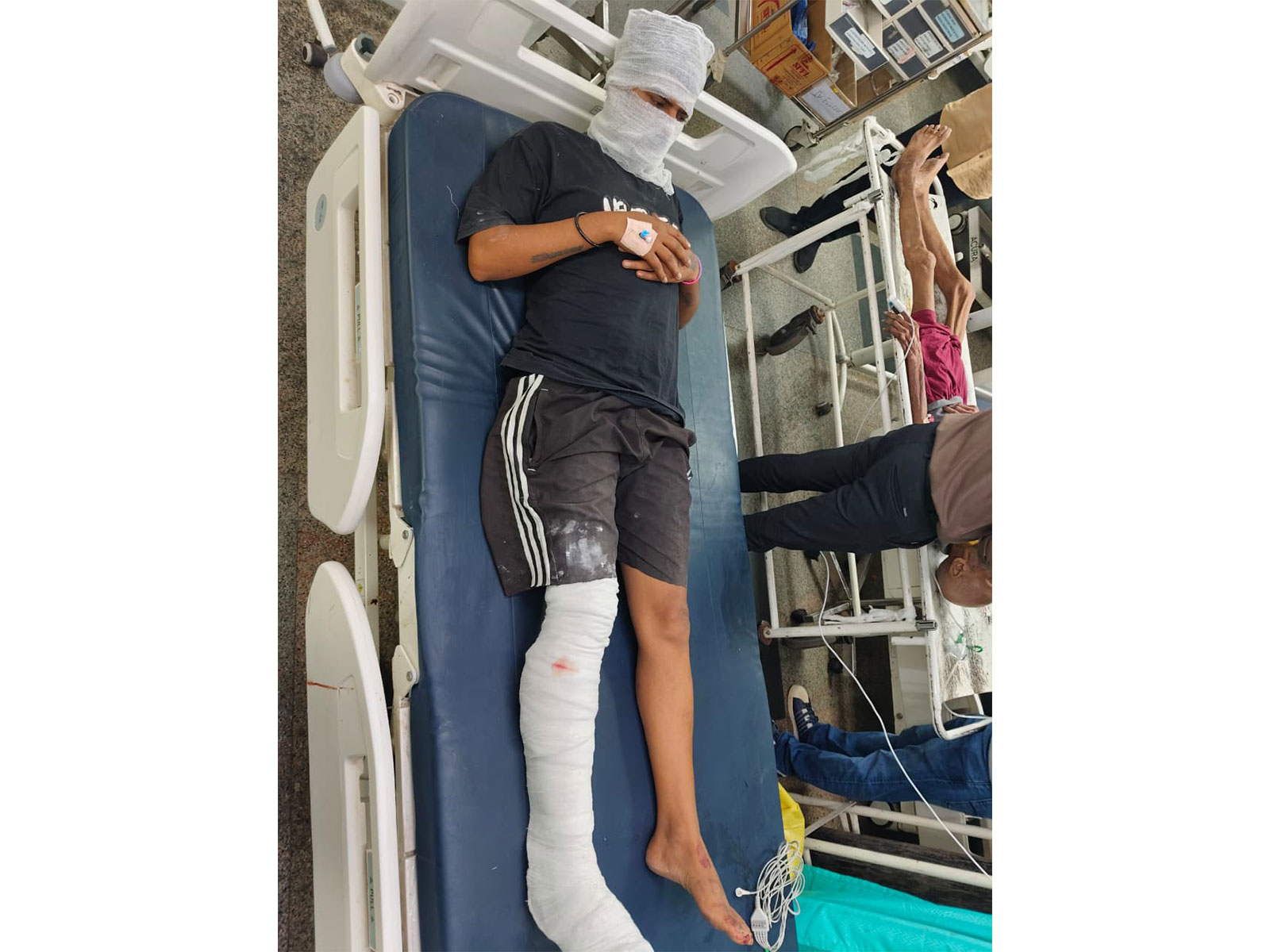 Wanted criminal in hospital after conflict with police (Photo/ANI) Wanted criminal in hospital after conflict with police (Photo/ANI)