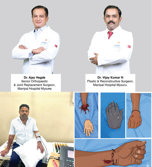 Manipal Hospitals, Mysuru successfully performed a complex hand replantation surgery Manipal Hospitals, Mysuru successfully performed a complex hand replantation surgery