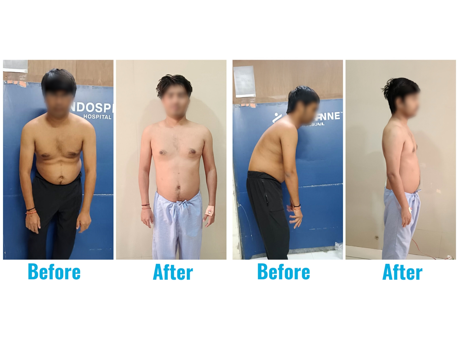 A 31-year-old who lived on a chair… until his spine finally said, ‘Enough’