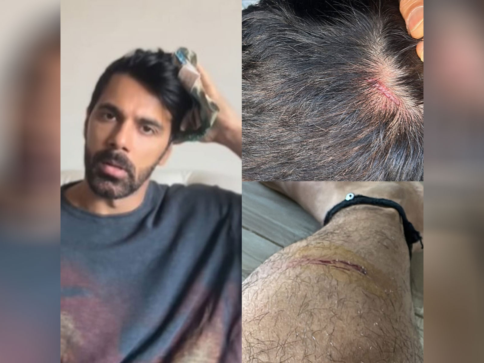 Anuj Sachdeva (Photo/instagram/@apnanuj) Anuj Sachdeva (Photo/instagram/@apnanuj)