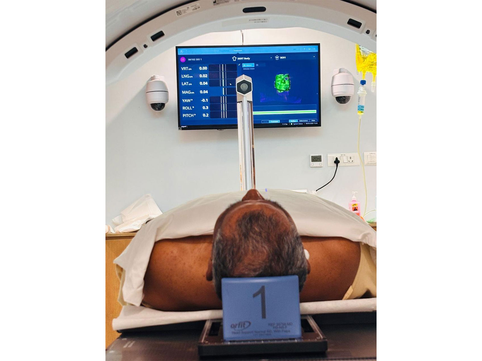 Sir HN Reliance Foundation Hospital achieves AI breakthrough in cancer care with mask-free, simulationless radiotherapy (Photo/Sir HN Reliance Foundation Hospital) Sir HN Reliance Foundation Hospital achieves AI breakthrough in cancer care with mask-free, simulationless radiotherapy (Photo/Sir HN Reliance Foundation Hospital)