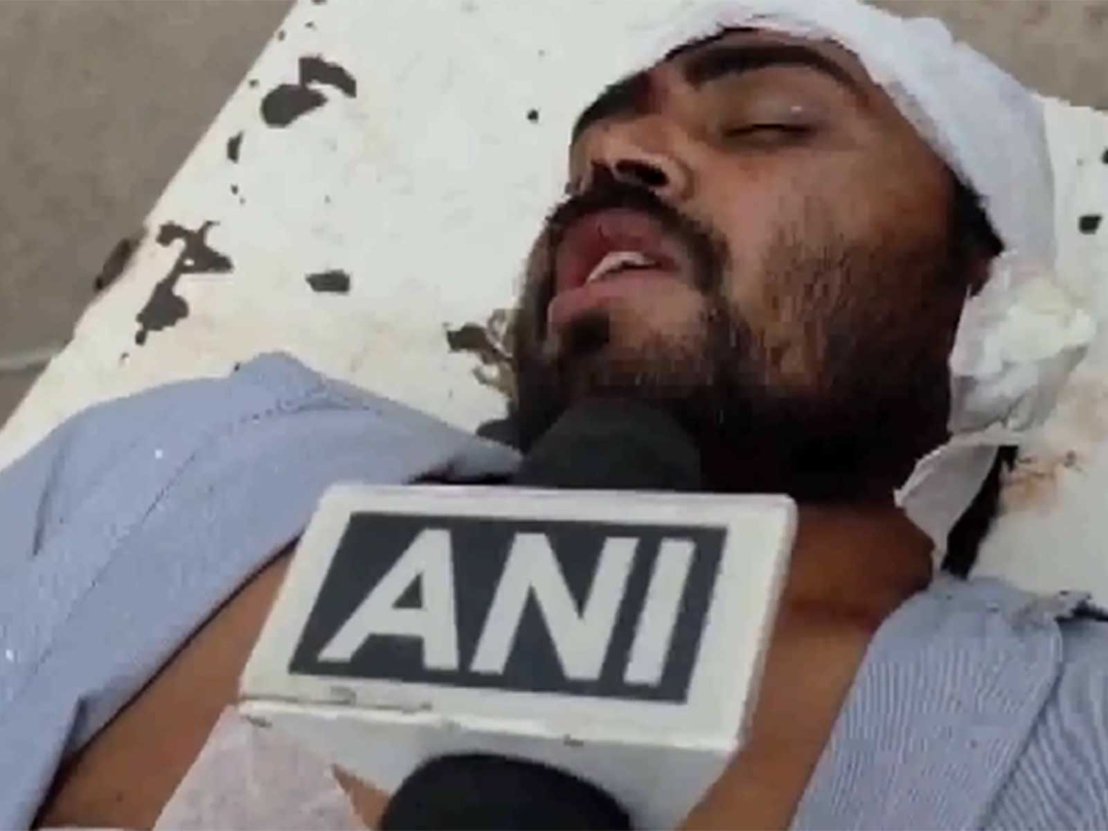 MP: Injured man Motilal Kushwaha (Photo/ANI)