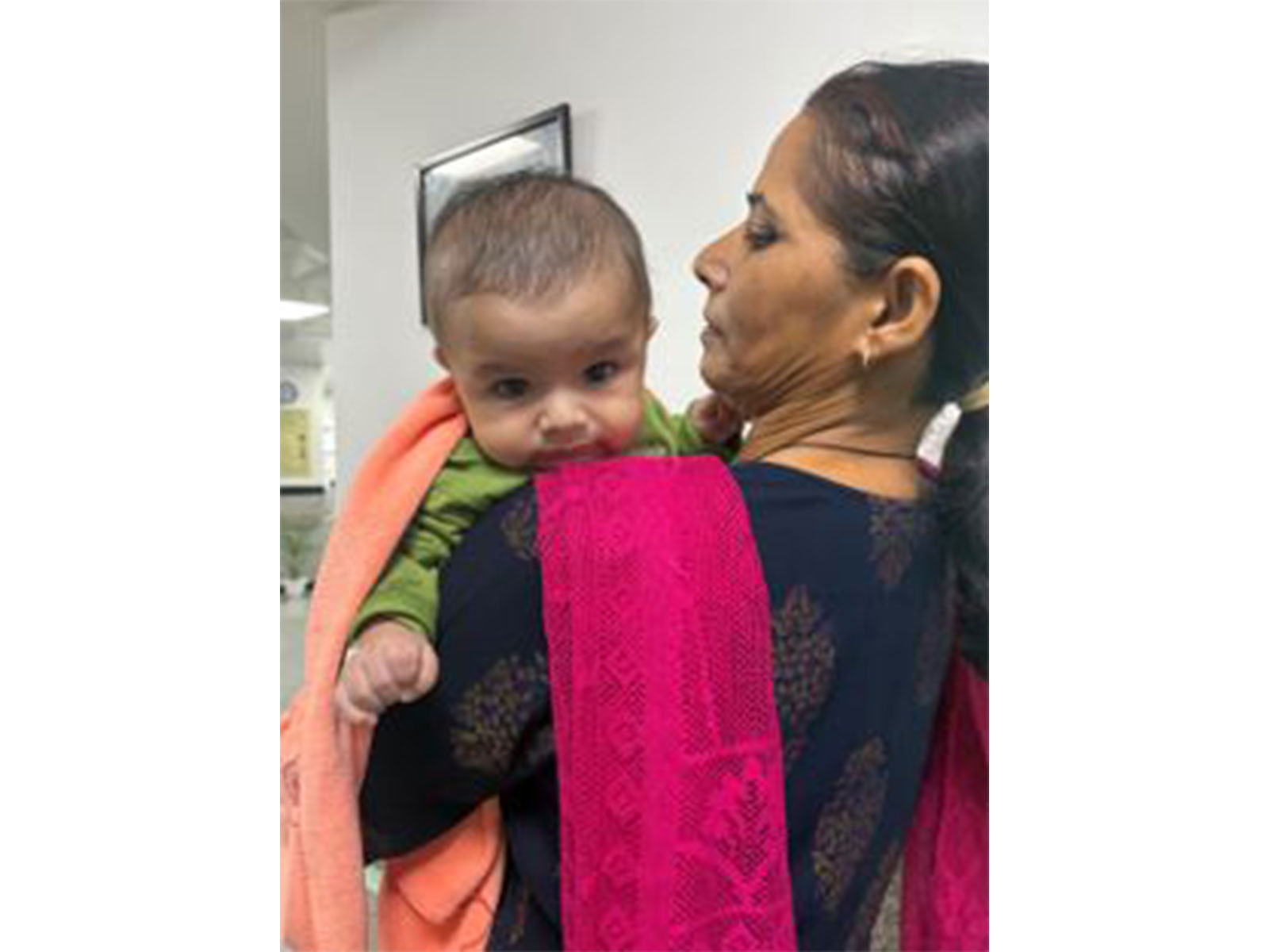 Four-month-old infant patient (Photo/ANI) Four-month-old infant patient (Photo/ANI)
