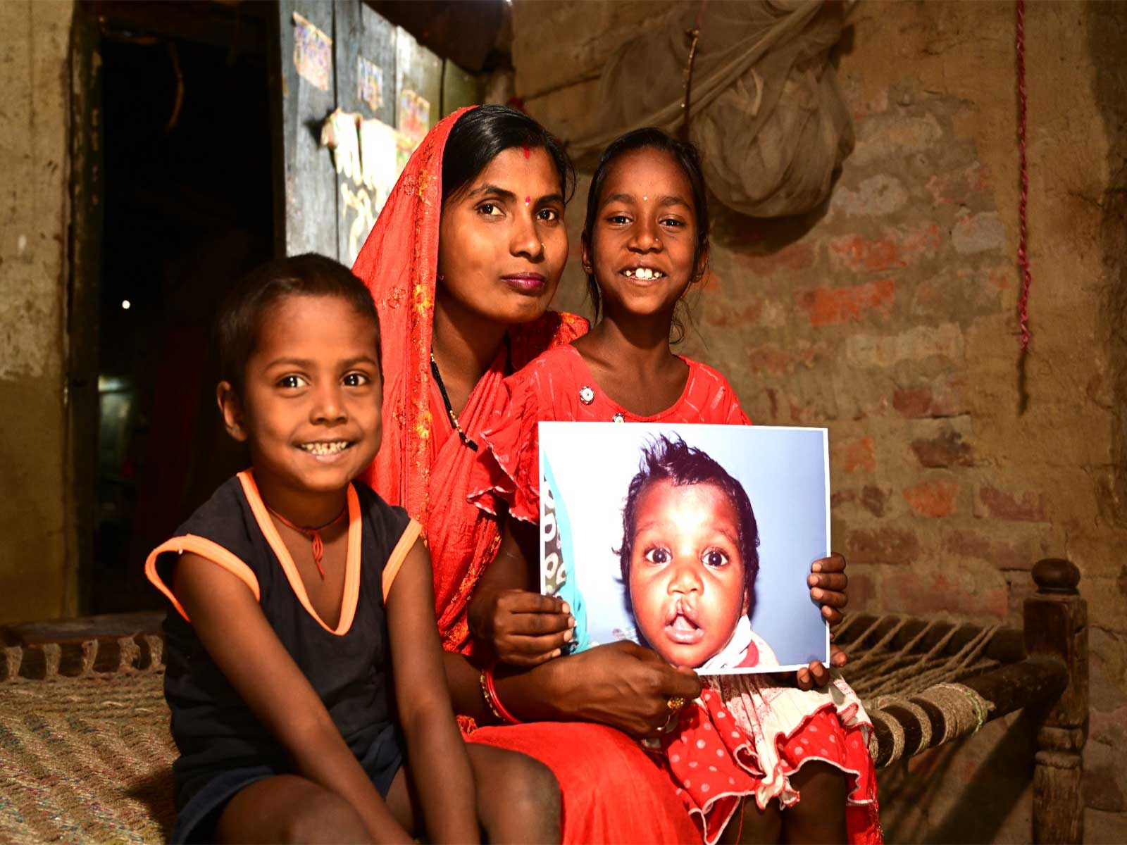 World Cleft Awareness Day, Smile Train India Marks 800,000+ Free Surgeries