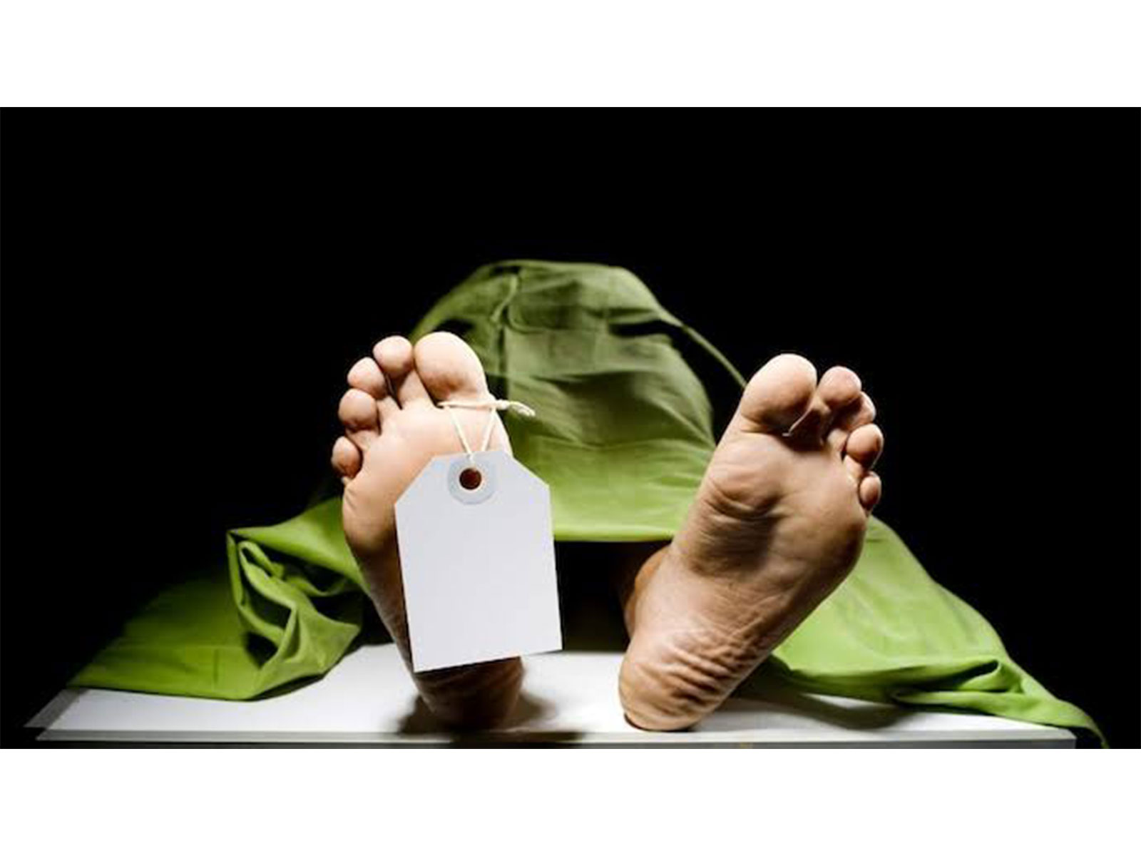 Nurse found dead at NRS Hospital (Representative Image) Nurse found dead at NRS Hospital (Representative Image)