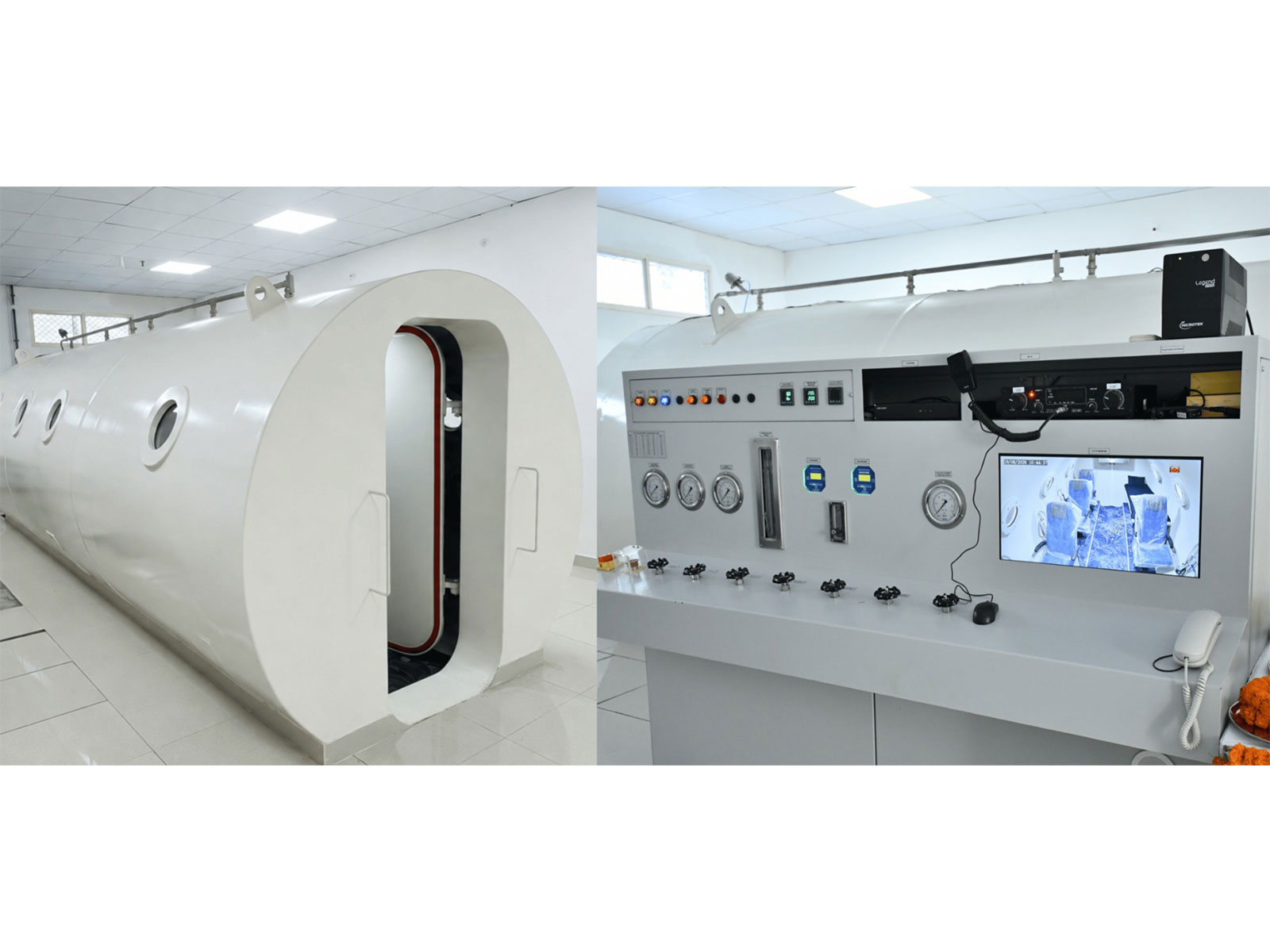 Bareilly’s SRMS Institute Of Medical Sciences Brings Hyperbaric Oxygen Therapy (HBOT) To Uttar Pradesh | Opens New Possibilities For Specialized Patient Care