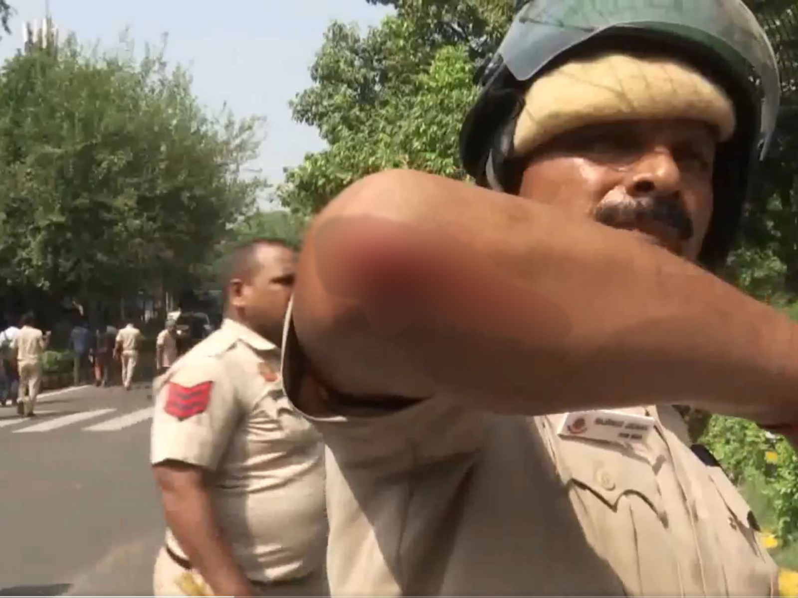 A Delhi Police official injured following reported stone-pelting and a scuffle during a protest near Connaught Place (Photo/ANI) A Delhi Police official injured following reported stone-pelting and a scuffle during a protest near Connaught Place (Photo/ANI)